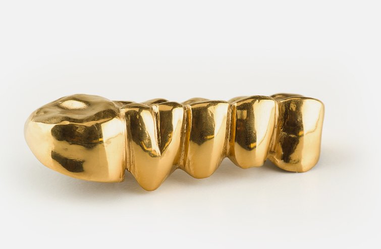 Gold verkaufen an und verkauf